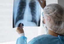 OMS aplicará una nueva estrategia contra la tuberculosis