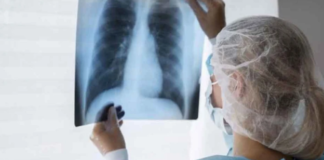 OMS aplicará una nueva estrategia contra la tuberculosis