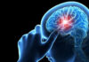Parche de seda podría ayudar al cerebro a recuperarse tras un ACV
