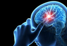 Parche de seda podría ayudar al cerebro a recuperarse tras un ACV