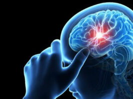 Parche de seda podría ayudar al cerebro a recuperarse tras un ACV