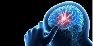 Parche de seda podría ayudar al cerebro a recuperarse tras un ACV