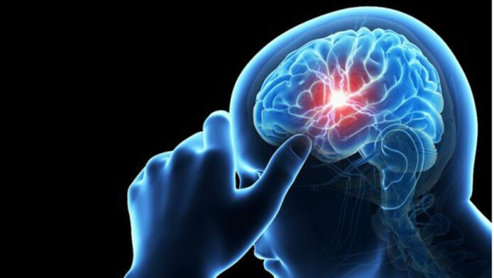 Parche de seda podría ayudar al cerebro a recuperarse tras un ACV