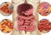 cebolla-cancer-colorrectal