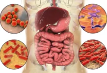 cebolla-cancer-colorrectal
