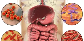 cebolla-cancer-colorrectal