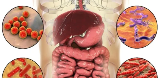 cebolla-cancer-colorrectal