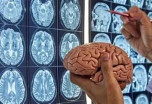 Buscan frenar el alzheimer con fármaco a base de cobre El fármaco a base de cobre