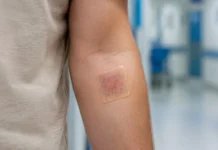 Investigadores desarrollan un “vendaje vivo” capaz de cura heridas en tiempo récord Vendaje vivo