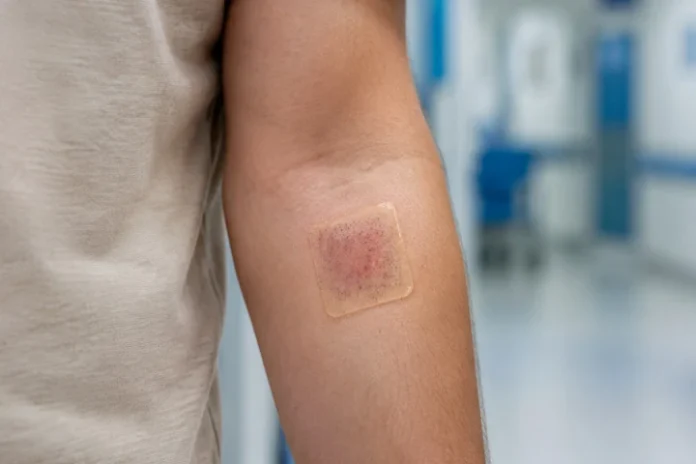 Investigadores desarrollan “vendaje vivo” capaz de cura heridas Vendaje vivo