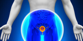 pruebas-existen-cancer-de-próstata-1