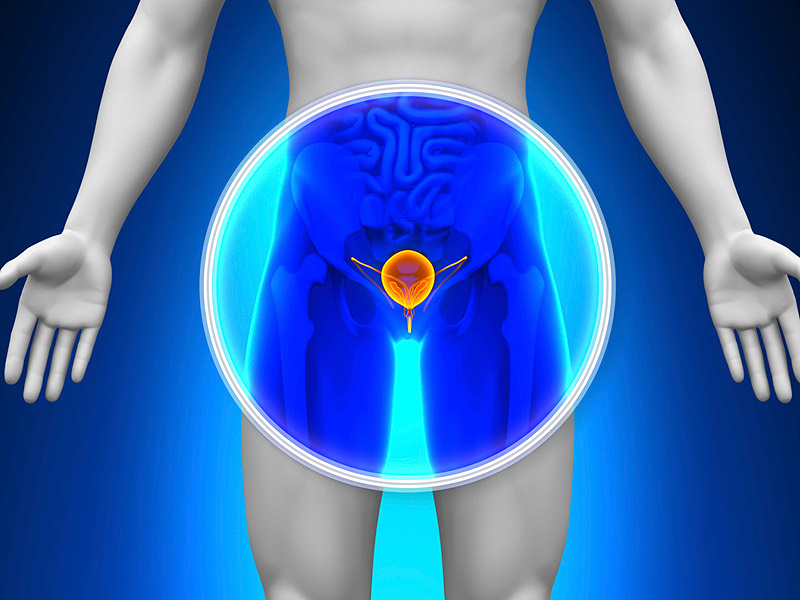 pruebas-existen-cancer-de-próstata-1 pruebas-existen-cancer-de-próstata-1
