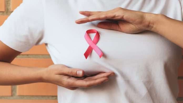 Sociedad contra el cáncer Sociedad contra el cáncer