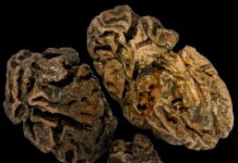 El misterio del cerebro humano