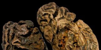 El misterio del cerebro humano
