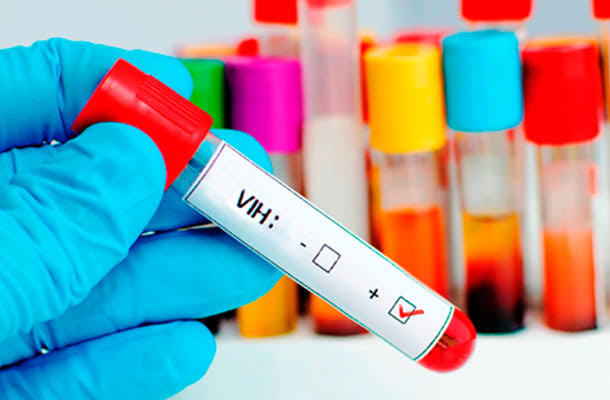 Prueban nuevo medicamento contra el VIH en humanos y los resultados son alentadores Medicamento contra el VIH