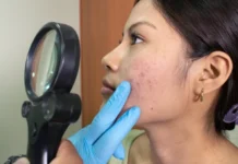 Sociedad Venezolana de Dermatología alerta contra consejos de salud de influencers Dermatología-856x647