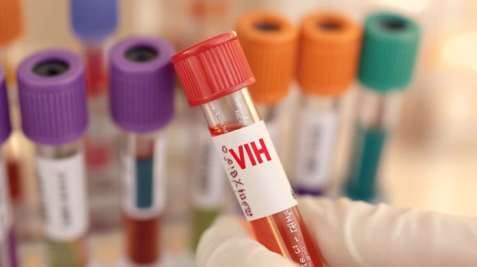 Fiyi declara emergencia nacional por contagio de VIH Fiyi declara emergencia nacional por contagio de VIH