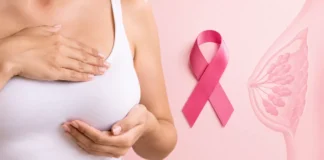 Guía Salud | OMS asegura que 80 % de los casos de cáncer de mama ocurre sin factores de riesgos Casos de cáncer de mama ocurren un 80% sin factores de riesgos